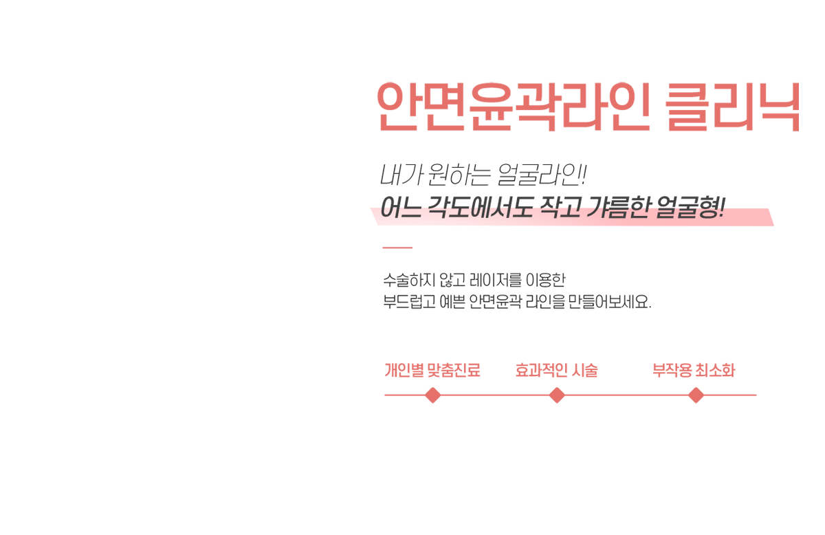 안면윤곽